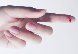 <strong>อ่านเพิ่มเติมเกี่ยวกับ</strong><br>ทำไมกระดาษบาดจึงรู้สึกเจ็บมากกว่า? ทำไมกระดาษบาดจึงรู้สึกเจ็บมากกว่า?