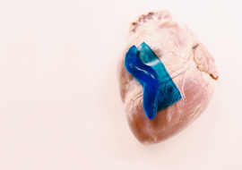 <strong>อ่านเพิ่มเติมเกี่ยวกับ</strong><br>ทากสู่การพัฒนาพลาสเตอร์ปิดแผล ทากสู่การพัฒนาพลาสเตอร์ปิดแผล